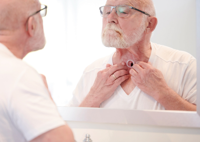 Man with beard and glass wearing a white t-shirt is looking in the mirror at his open stoma.