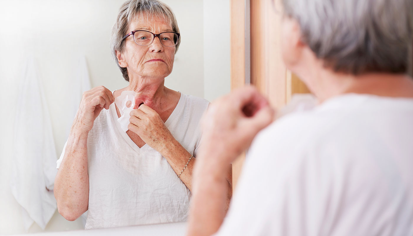 Woman with a neck stoma changing her adhesive.